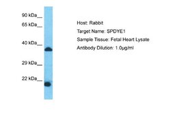 SPDYE1 Rabbit anti-Human, Polyclonal, Novus Biologicals 0.1 mL | Buy Online | Novus Biologicals | Fisher Scientific